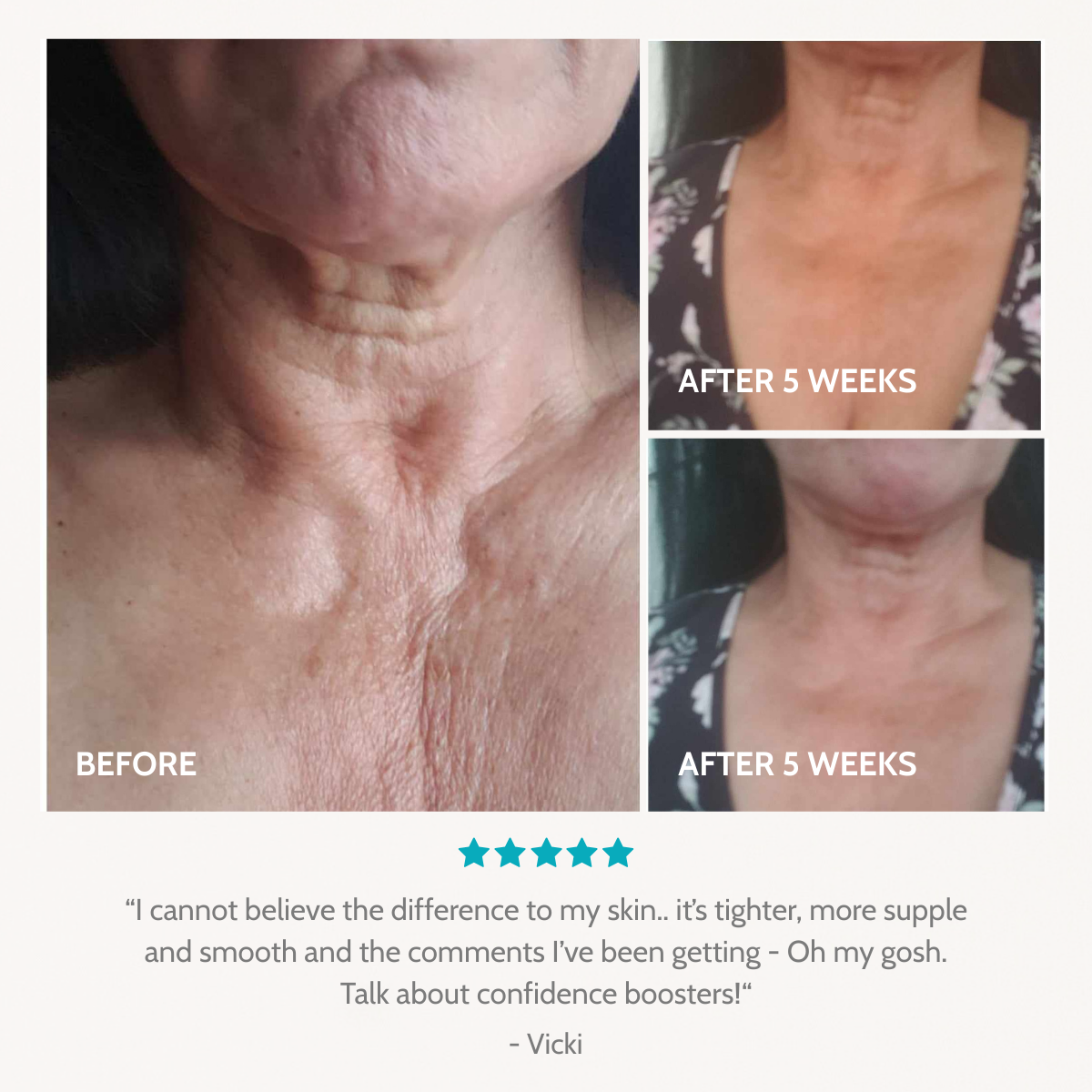 Healthy Skin Starter Kit | 21-Day Trial