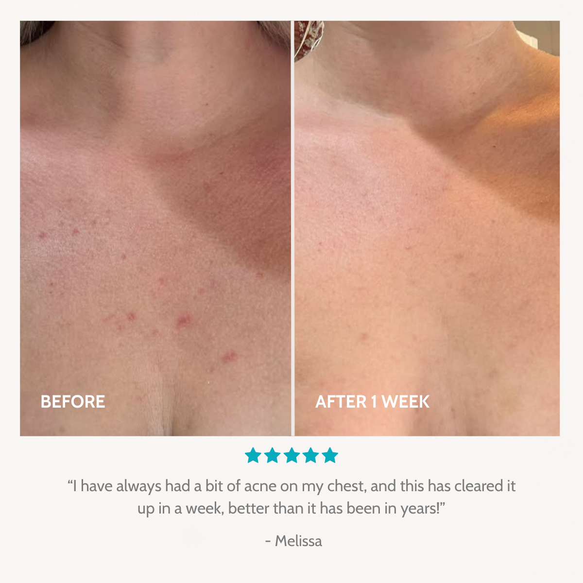 Healthy Skin Starter Kit | 21-Day Trial