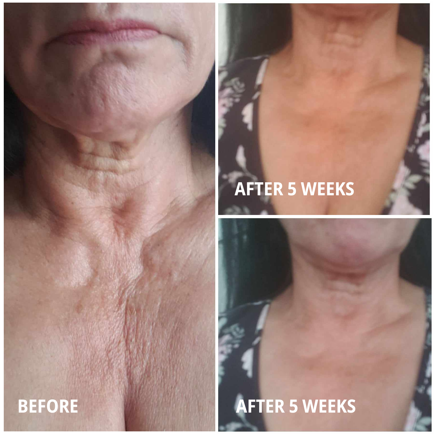 Hydrate: Hyaluronic Acid Serum